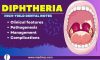 Diphtheria Dental Notes – NBDE, NEET MDS, Board Exams
