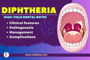 Diphtheria Dental Notes