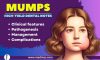 Mumps: Highyield Dental Notes