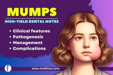 Mumps: Highyield Dental Notes