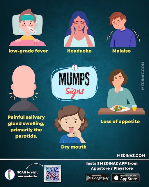 Mumps Signs & Symptoms