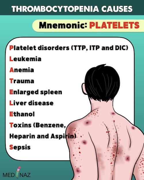 ‎Thrombocytopenia causes mnemonic