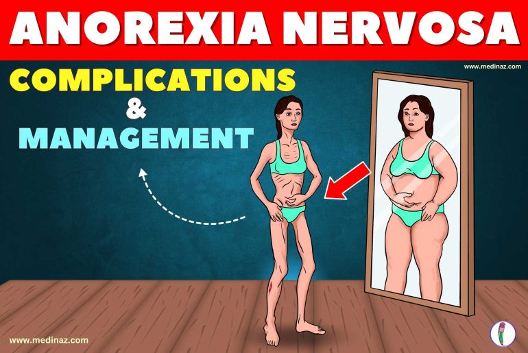 Anorexia Nervosa Complications and Management