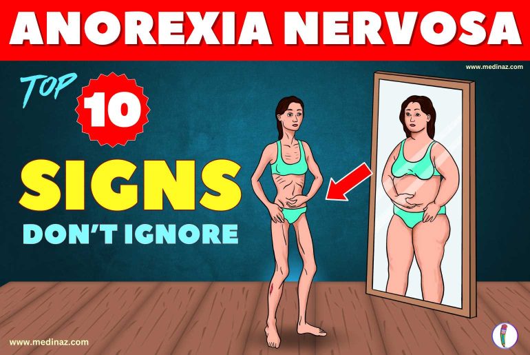 Top 10 Anorexia Nervosa Symptoms