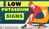 Top 10 Low Potassium Symptoms: Understanding Hypokalemia