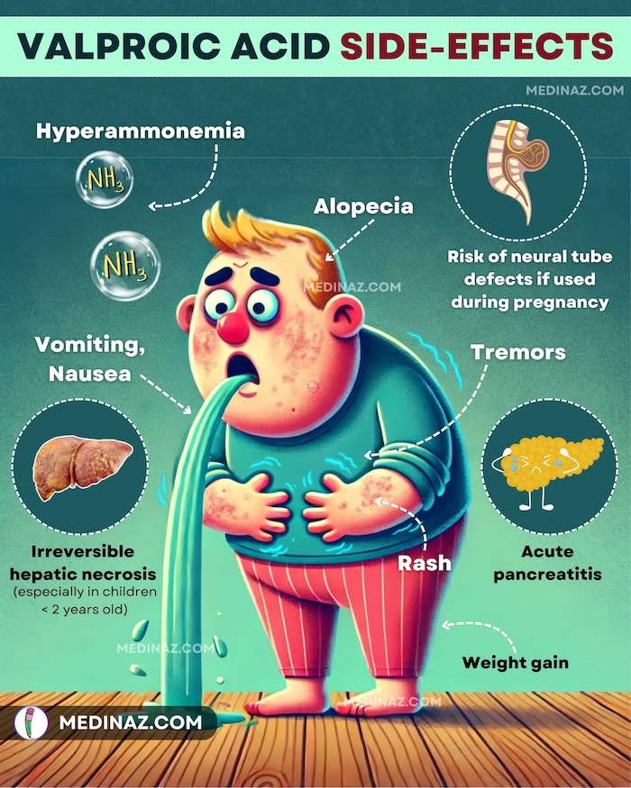 Valproic Acid Side-effects Mnemonic