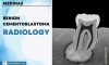 Benign Cementoblastoma Radiology: Dental Notes