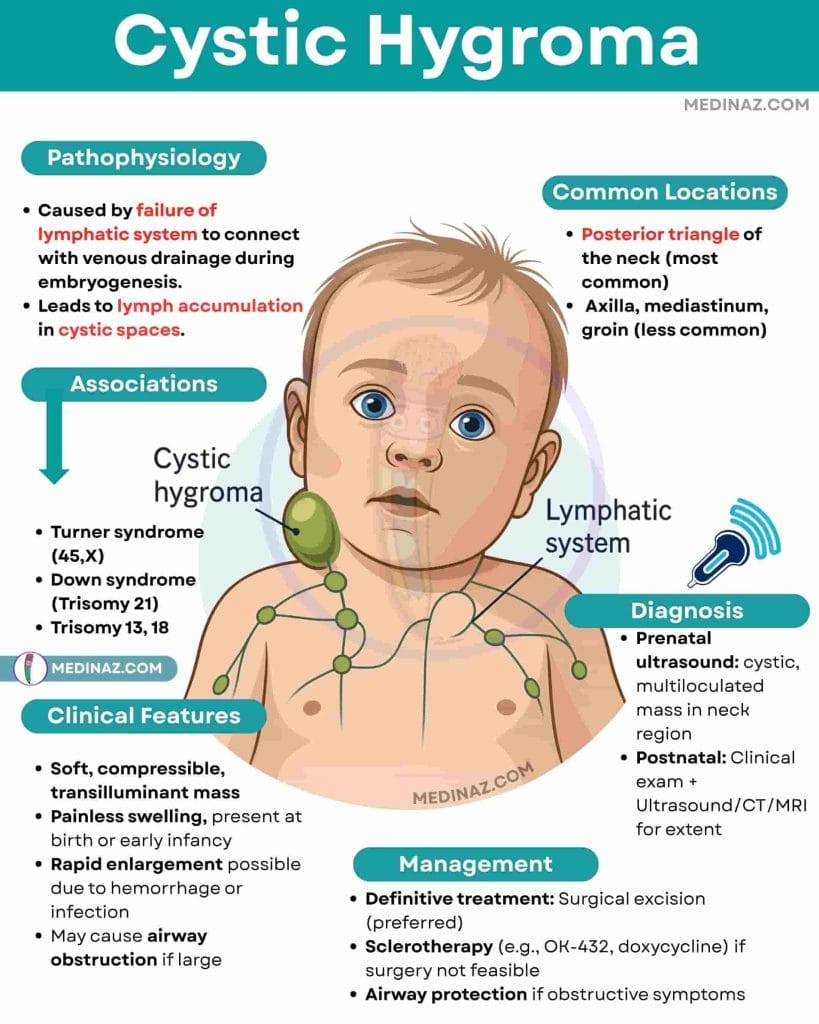 Cystic Hygroma Highyield Notes
