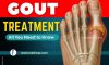 Gout Treatment – All You Need to Know