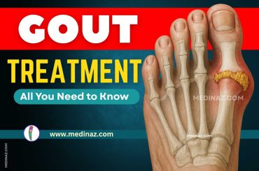 Gout Treatment - All You Need to Know