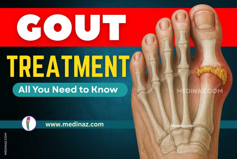 Gout Treatment - All You Need to Know