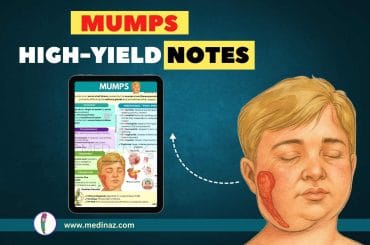 Mumps Symptoms, Etiology, Treatment - Medicine Notes