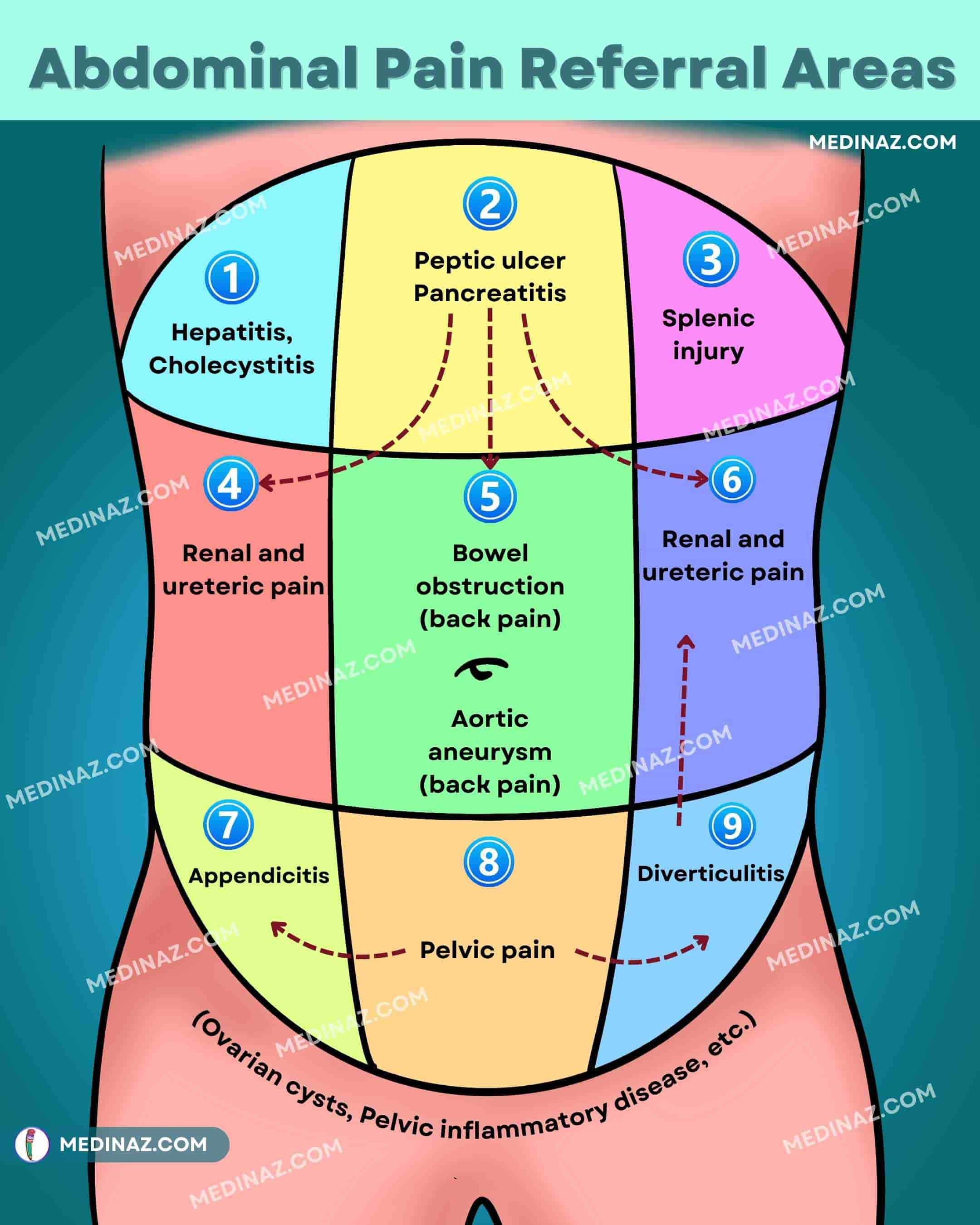 Abdominal Pain Referral Areas Image